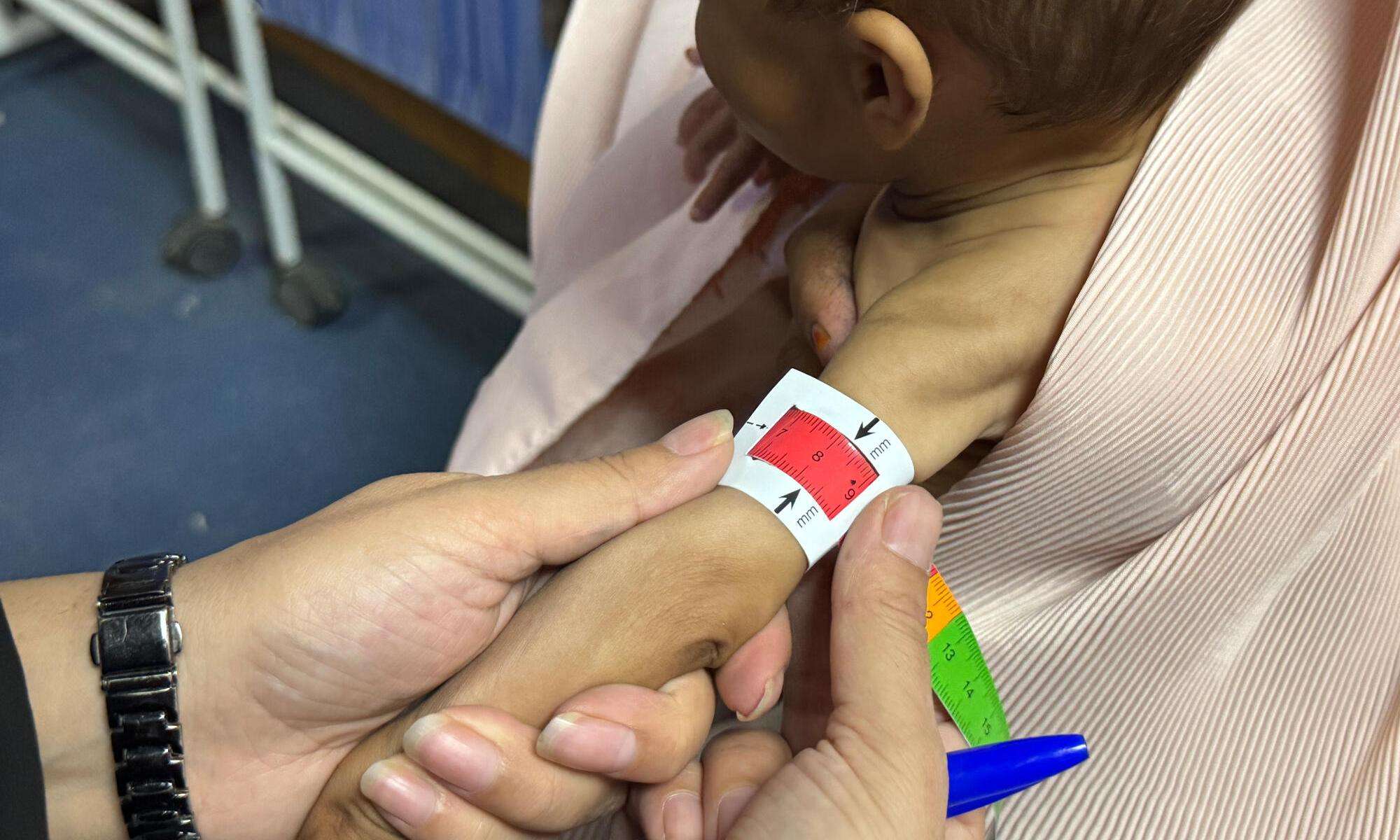 An MSF nurse measures a child's mid-upper arm circumference (MUAC) to assess a baby during triage at MSF's outpatient therapeutic feeding center in Kandahar.
