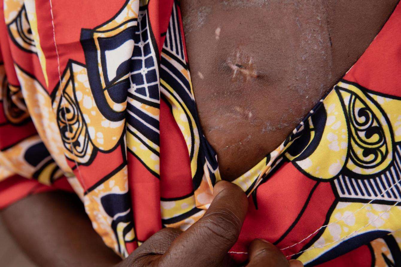 The journey of a wounded woman at MSF'SICA hospital in Bangui
