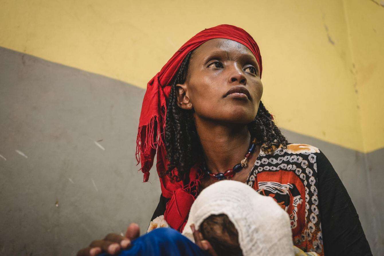 Nutritional crisis in Ethiopia's Afar region