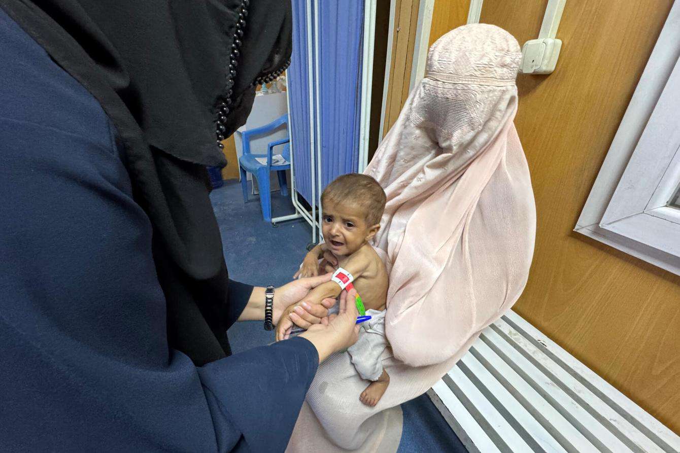 An MSF nurse measures a child's mid-upper arm circumference (MUAC) to assess malnutrition at MSF's outpatient therapeutic feeding center in Kandahar.