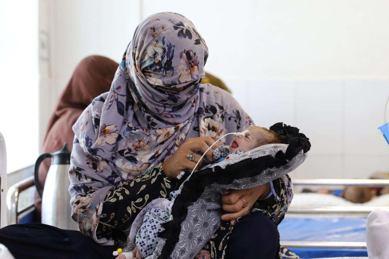 A mother holds her malnourished child in Afghanistan.