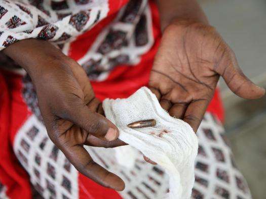 Woman's hands holding bullet extracted from her neck after fleeing Sudan to Chad