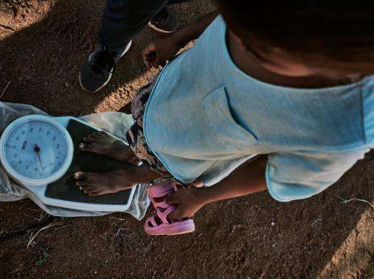 A child stands on a scale to record his weight during an acute malnutrition crisis in Madagascar.