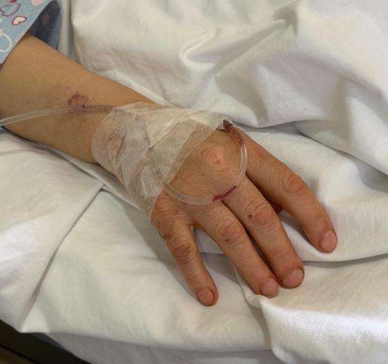 A close-up photo of a hand in a hospital bed in Lebanon. 